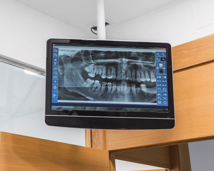 X-Ray Technology For Dental Care